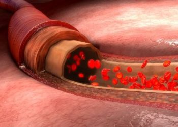 Blood Vessels – Oren Zarif