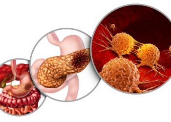 oren zarif price | oren zarif review | oren zarif costs