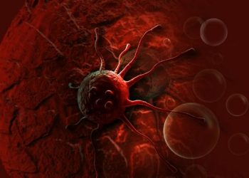 Tongue Cancer – Diagnosis and Treatment – Oren Zarif