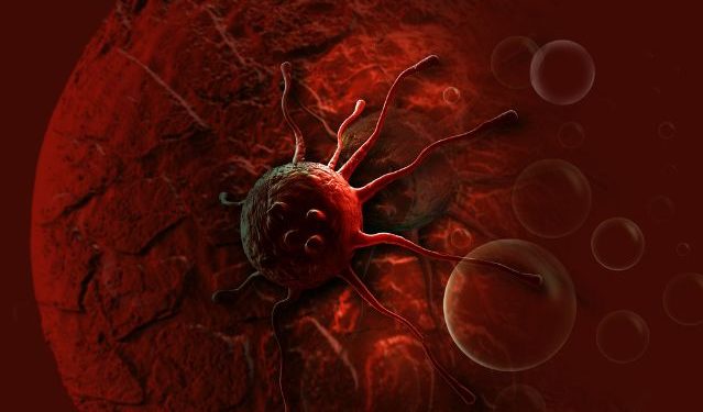 Tongue Cancer – Diagnosis and Treatment – Oren Zarif