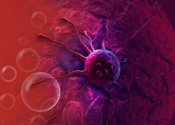 Moles Cancer – Why It’s Important to Remove Moles on Your Body – Oren Zarif