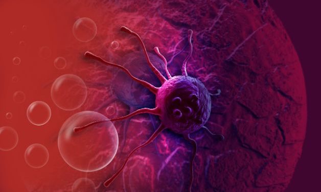Moles Cancer – Why It’s Important to Remove Moles on Your Body – Oren Zarif