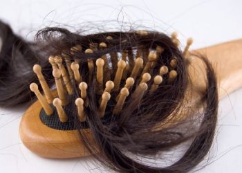 Hair loss – Oren Zarif