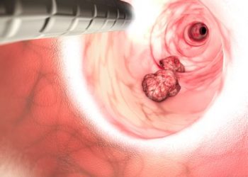 Is Cancer a Disease of Evolution? – Oren Zarif