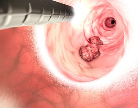 Is Cancer a Disease of Evolution? – Oren Zarif