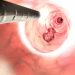 Is Cancer a Disease of Evolution? – Oren Zarif