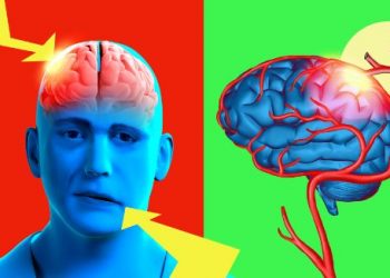 Facial Paralysis – Oren Zarif