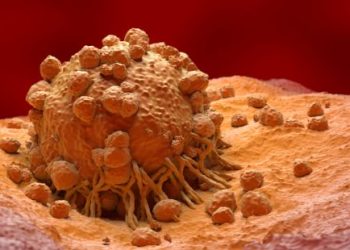 What You Should Know About Cancer – Oren Zarif