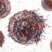 Is Breast Cancer Curable? – Oren Zarif