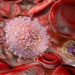 Is Lung Cancer Curable? – Oren Zarif