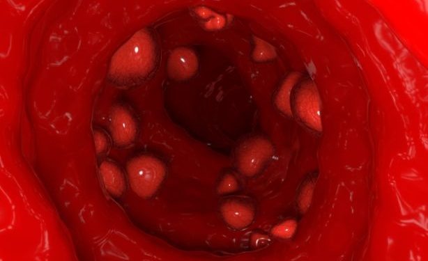 Symptoms of Skin Cancer – Oren Zarif