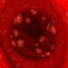 Symptoms of Skin Cancer – Oren Zarif