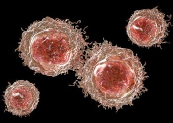 Skin Cancer Treatment – Oren Zarif