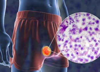 Is Skin Cancer Curable? – Oren Zarif