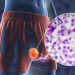 Is Skin Cancer Curable? – Oren Zarif