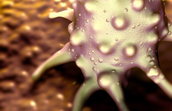 Colon Cancer Symptoms and Treatment – Oren Zarif