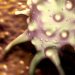 Colon Cancer Symptoms and Treatment – Oren Zarif