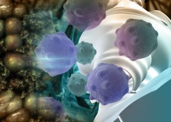 Kidney Cancer Treatment – Oren Zarif