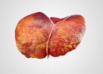 oren zarif price | oren zarif review | oren zarif costs