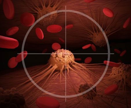 oren zarif price | oren zarif review | oren zarif costs