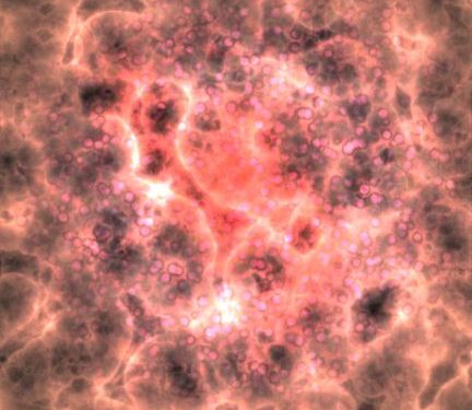 Cancer Stem Cells – Oren Zarif