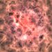 Cancer Stem Cells – Oren Zarif