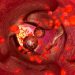 How to Help on World Cancer Day – Oren Zarif