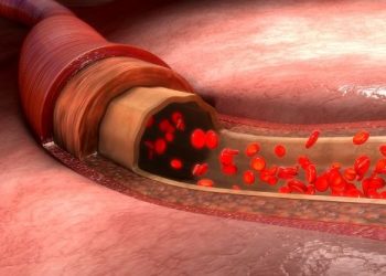 How Many Cancer Cases Per Year? – Oren Zarif