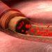How Many Cancer Cases Per Year? – Oren Zarif