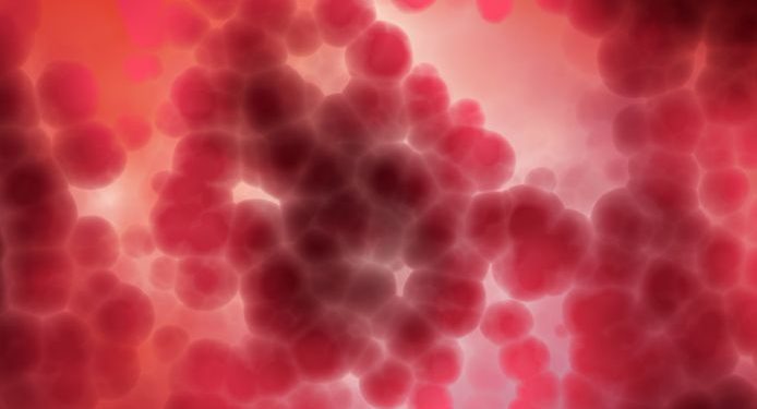 Cancer of the Cervix in India – Oren Zarif