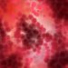 Cancer of the Cervix in India – Oren Zarif