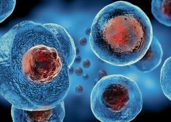 Treatment For Cancer Near the Anus – Oren Zarif