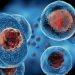 Treatment For Cancer Near the Anus – Oren Zarif