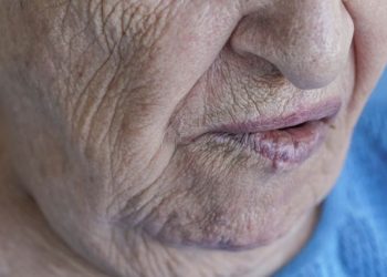 Breast Cancer Symptoms and Diagnosis – Oren Zarif