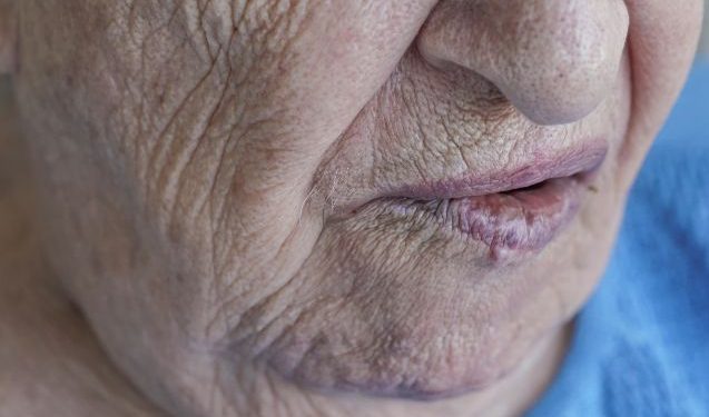 Breast Cancer Symptoms and Diagnosis – Oren Zarif