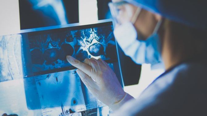 Will Cancer Show Up on a CT Scan? – Oren Zarif