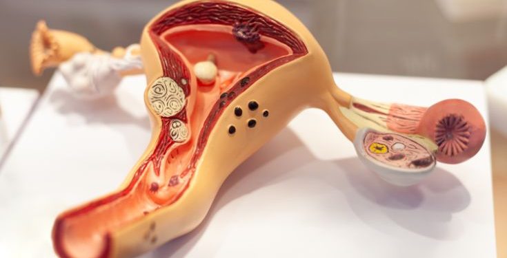 Can Cancer Cause High Blood Pressure? – Oren Zarif
