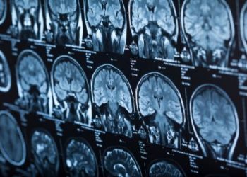 The Different Stages of Colon Cancer – Oren Zarif