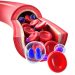 Why Cancer Happens? – Oren Zarif