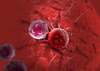 Symptoms and Treatment for Mouth Cancer – Oren Zarif