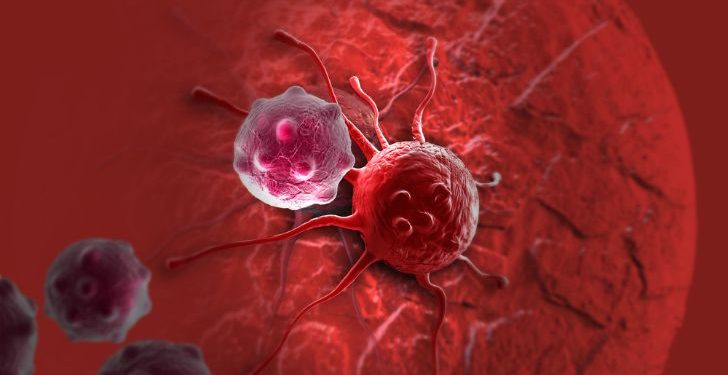 Symptoms and Treatment for Mouth Cancer – Oren Zarif