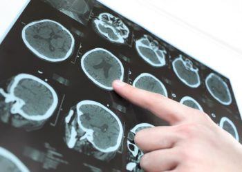 Which Cancer is the Most Curable? – Oren Zarif