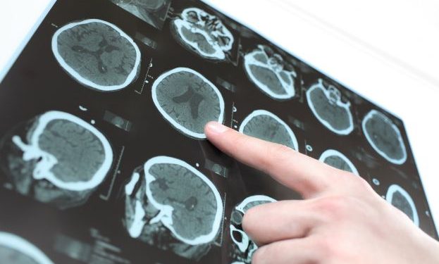 Which Cancer is the Most Curable? – Oren Zarif