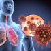 How Much Cancer Is Caused by Smoking? – Oren Zarif