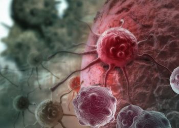 Symptoms and Signs of Mouth Cancer – Oren Zarif