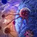 Rectal Cancer Symptoms and Treatment – Oren Zarif