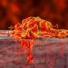 How Colon Cancer is Treated – Oren Zarif