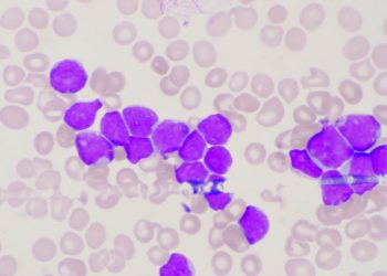 Colon Cancer Treatments and Screenings – Oren Zarif