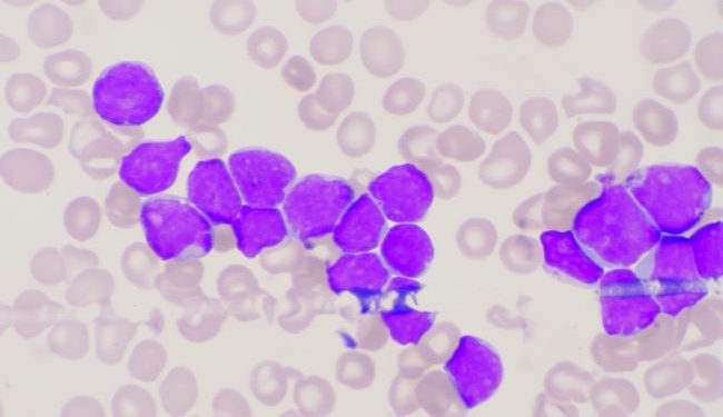 Colon Cancer Treatments and Screenings – Oren Zarif