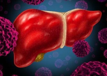 Important Things to Know About Cancer Stage 1 – Oren Zarif